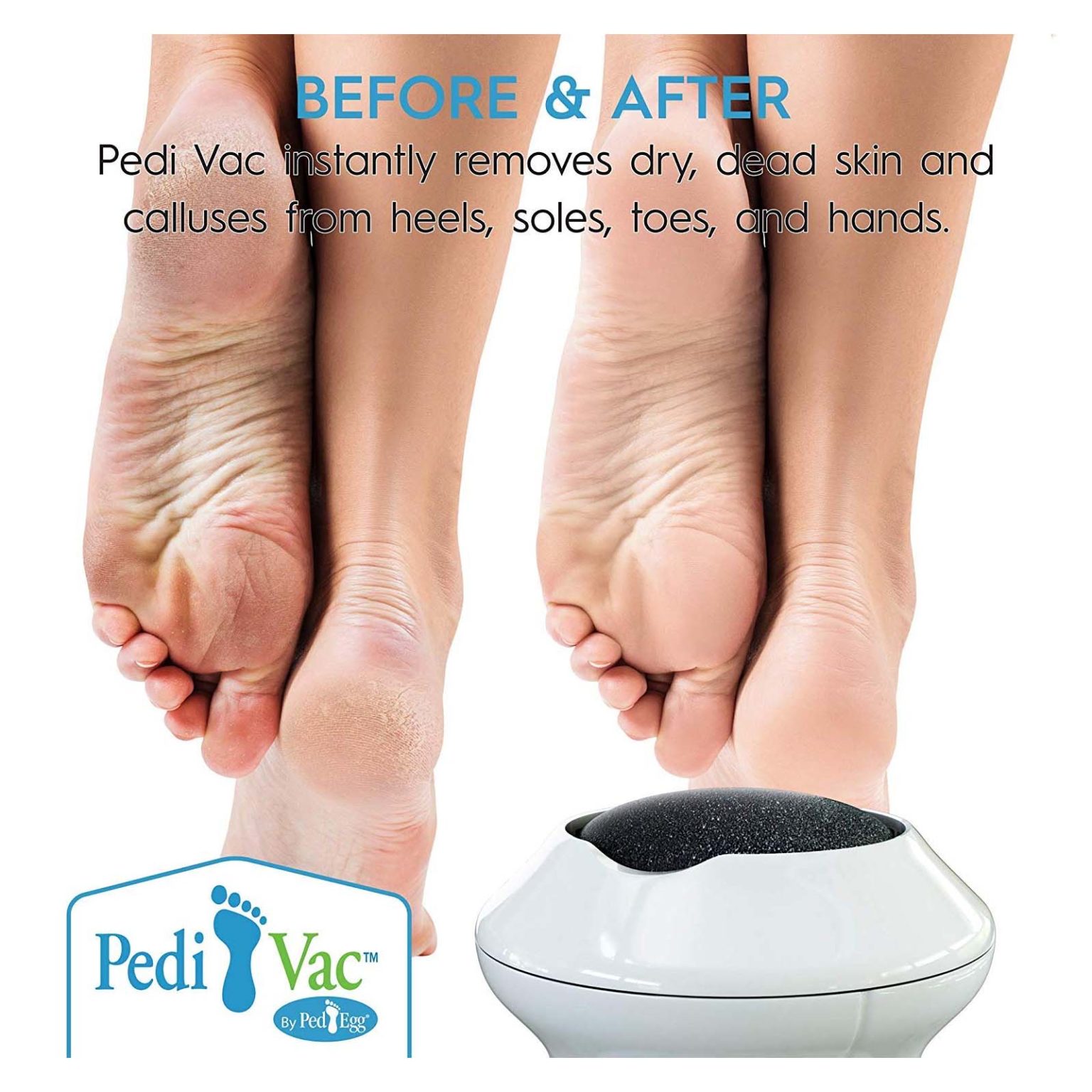 PEDI VAC | Best Of As Seen On TV
